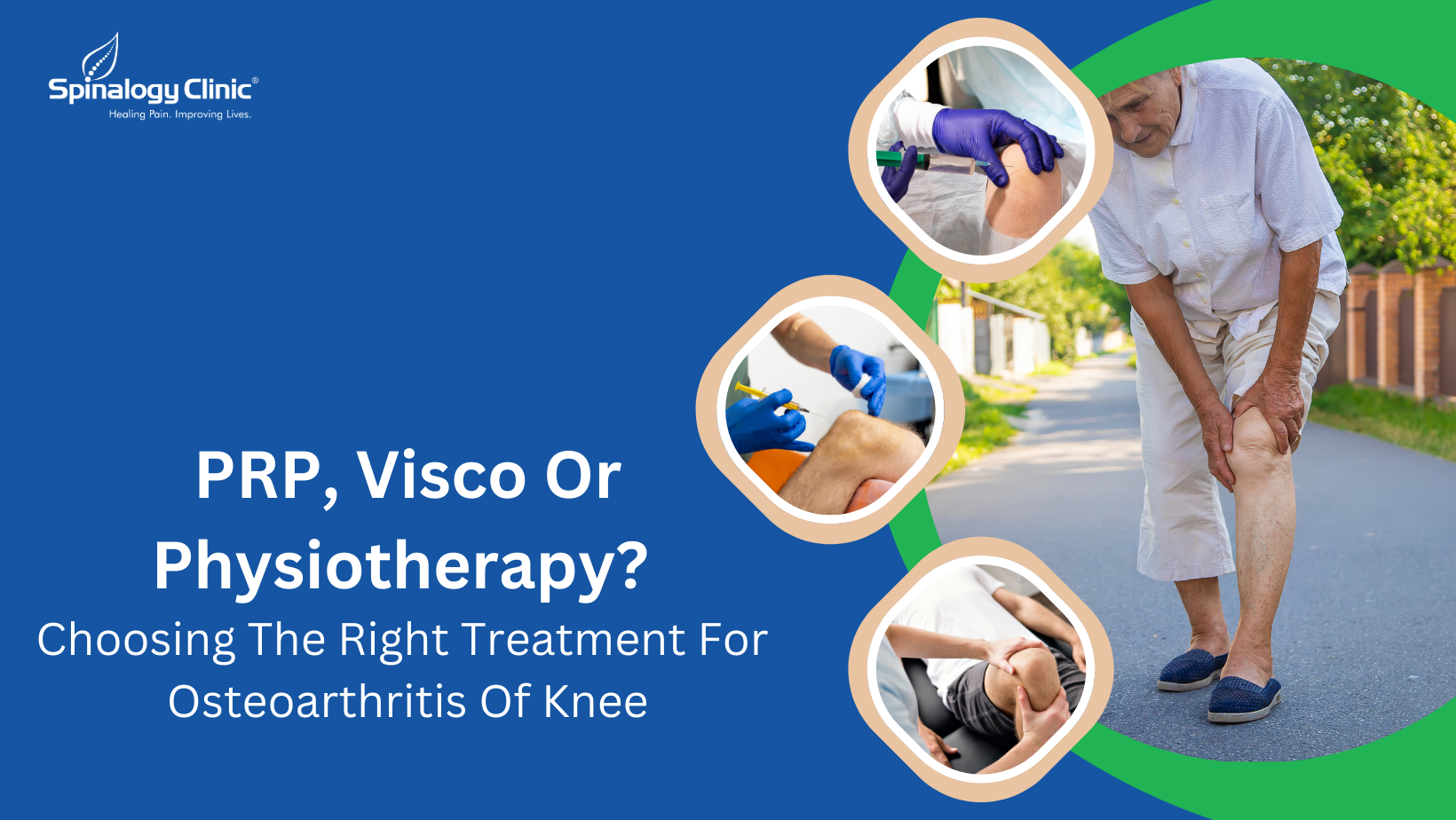 PRP, Visco Or Physiotherapy? Choosing The Right Treatment For OA Knee